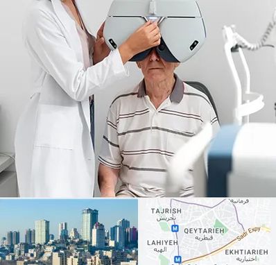 دکتر سرطان چشم در قیطریه 