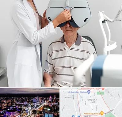 دکتر سرطان چشم در گلسار رشت 