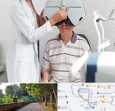 دکتر سرطان چشم در فلکه گاز رشت 