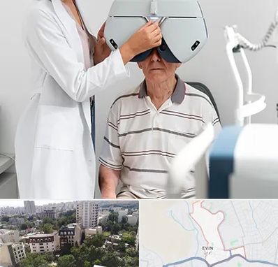 دکتر سرطان چشم در اوین