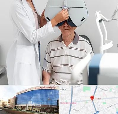 دکتر سرطان چشم در نصف راه تبریز