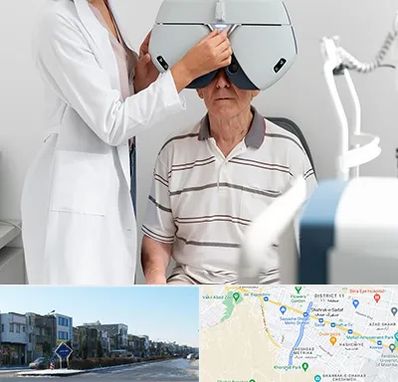 دکتر سرطان چشم در شریعتی مشهد 