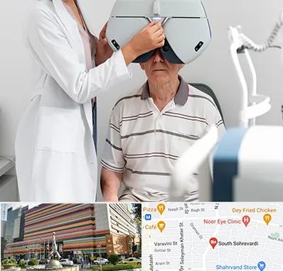 دکتر سرطان چشم در سهروردی 