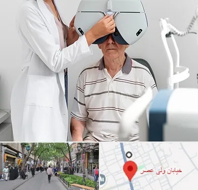 دکتر سرطان چشم در ولیعصر شهریار