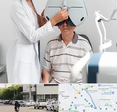 دکتر سرطان چشم در قدوسی شرقی شیراز 