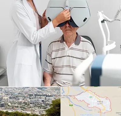 دکتر سرطان چشم در یاسوج