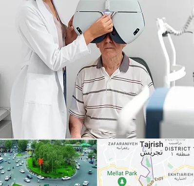 دکتر سرطان چشم در تجریش 