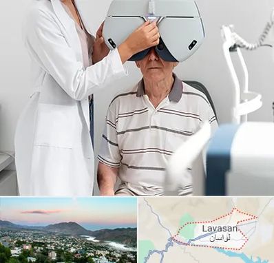 دکتر سرطان چشم در لواسان