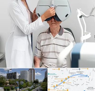 دکتر سرطان چشم در اندرزگو 