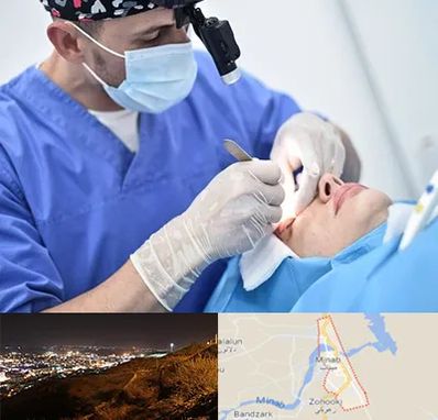 جراح سرطان چشم در میناب