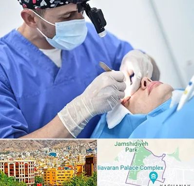 جراح سرطان چشم در نیاوران 