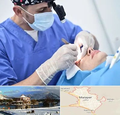 جراح سرطان چشم در ملایر