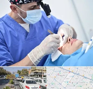 جراح سرطان چشم در مفتح مشهد 