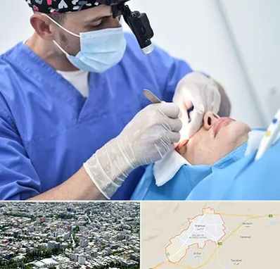 جراح سرطان چشم در شاهرود