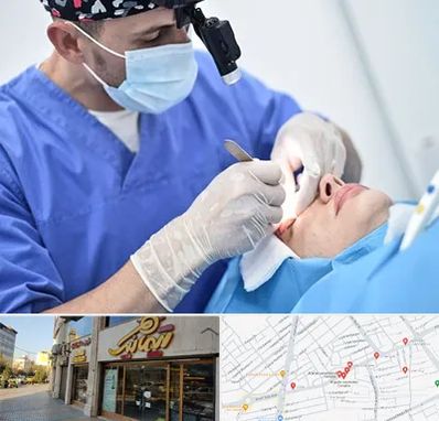 جراح سرطان چشم در عطاران قم