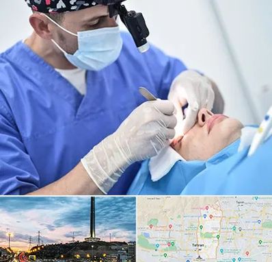 جراح سرطان چشم در منطقه 2 تهران 