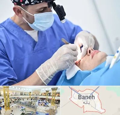 جراح سرطان چشم در بانه