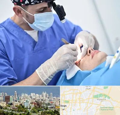 جراح سرطان چشم در شرق تهران 