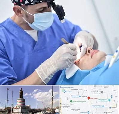 جراح سرطان چشم در کارگر جنوبی 