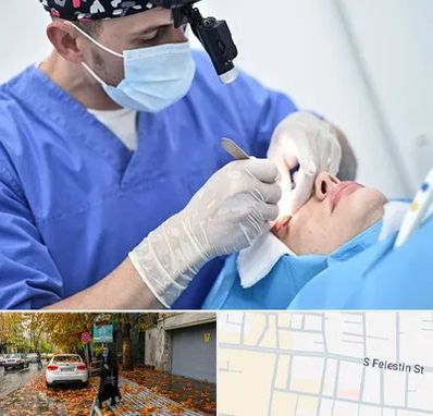 جراح سرطان چشم در خیابان فلسطین