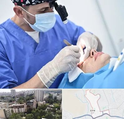 جراح سرطان چشم در اوین