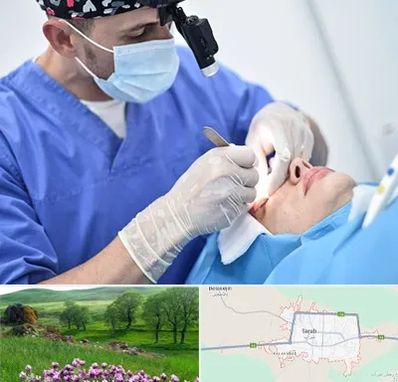 جراح سرطان چشم در سراب