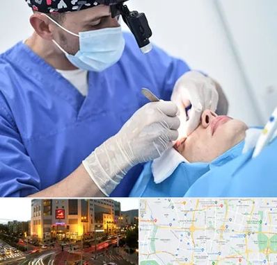 جراح سرطان چشم در جنت آباد تهران 