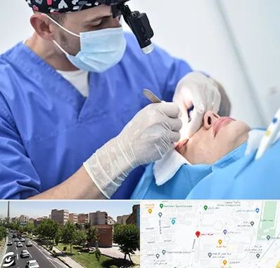 جراح سرطان چشم در شهرک آزمایش 