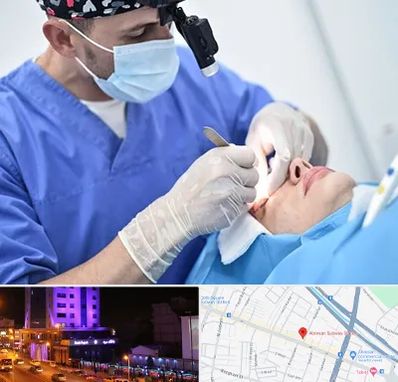 جراح سرطان چشم در آبرسان تبریز