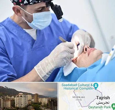 جراح سرطان چشم در زعفرانیه 