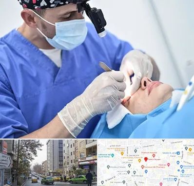 جراح سرطان چشم در فاطمی 