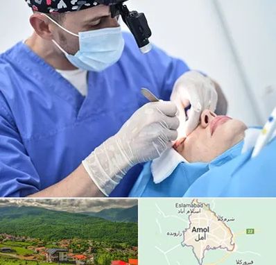 جراح سرطان چشم در آمل