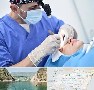 جراح سرطان چشم در ایلام