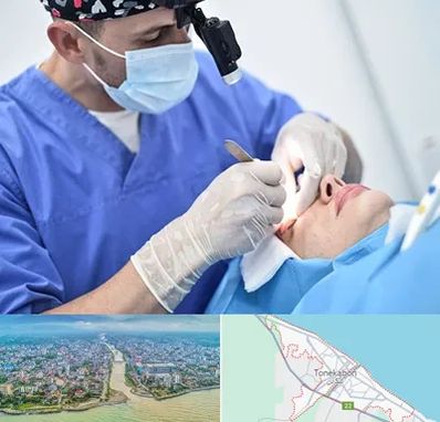 جراح سرطان چشم در تنکابن