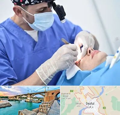 جراح سرطان چشم در دزفول