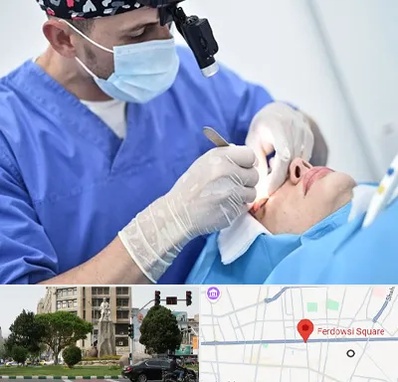 جراح سرطان چشم در میدان فردوسی تهران