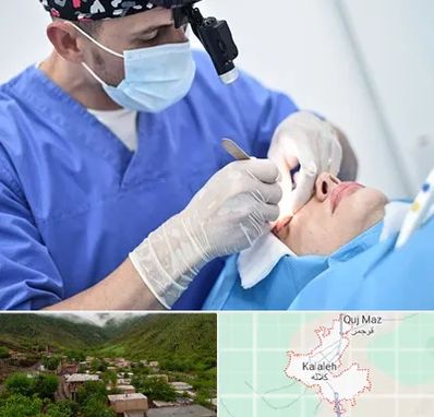 جراح سرطان چشم در کلاله