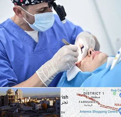 جراح سرطان چشم در فرمانیه 