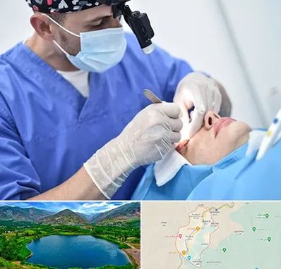 جراح سرطان چشم در رودبار