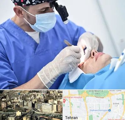 جراح سرطان چشم در مرزداران 