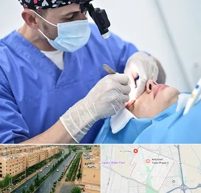 جراح سرطان چشم در فاز سه اندیشه