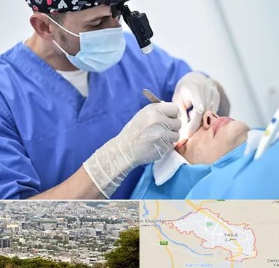 جراح سرطان چشم در یاسوج