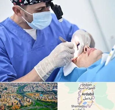 جراح سرطان چشم در اردبیل