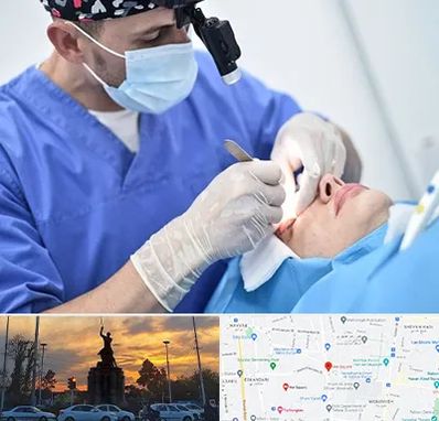 جراح سرطان چشم در میدان حر 