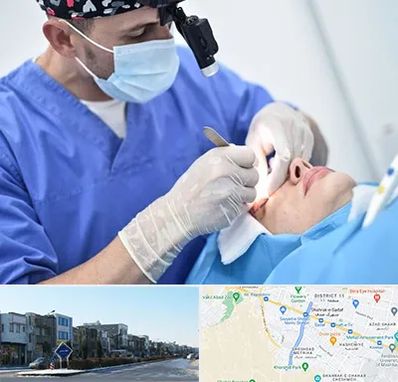 جراح سرطان چشم در شریعتی مشهد 