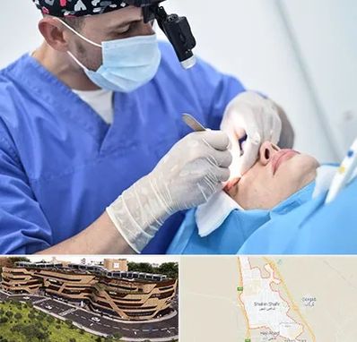 جراح سرطان چشم در شاهین شهر