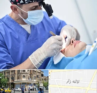 جراح سرطان چشم در لاله زار