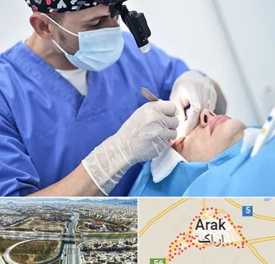جراح سرطان چشم در اراک