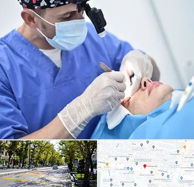 جراح سرطان چشم در میرداماد 