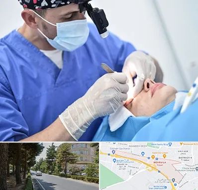 جراح سرطان چشم در مهرویلا کرج 